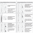 thumbnail image 3 of Blackhead removal tool set, 3 of 10