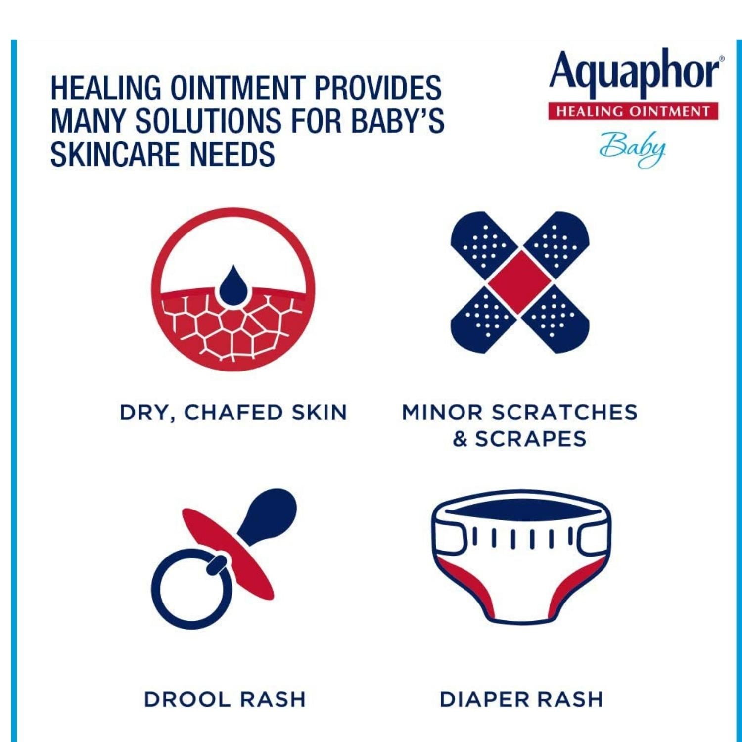 Aquaphor Baby Healing Ointment Advanced Therapy Skin Protectant, Dry Skin, and Diaper Rash Ointment, 7 Oz Tube