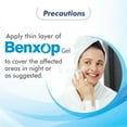 Salve Benxop Benzoyl Peroxide 2.5 Pimples Cream 20gm (0.70 Fl Oz
