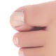 thumbnail image 5 of Gancho De Clavo Delantero Gancho de clavo frontal/banda de goma Herramienta de corrección de uñas encarnadas Clips de ortesis Ehuebsd Cuidado Belleza, 5 of 8