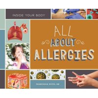 All about Allergies