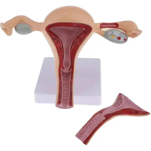 Uterus and Ovary Model, Anatomical Model of Female Reproductive Organs, Uterine Ovary Vaginal Teaching Tool with Removable Organs, for Doctor's Office and Classrooms, Medical Study Supplies