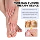 thumbnail image 2 of Dispositivo láser para hongos en las uñas Terapia de luz Tratamiento de onicomicosis en los dedos del pie Inicio -GSL, 2 of 5