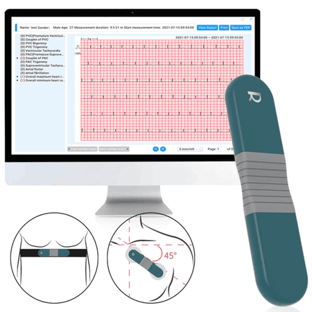Livenpace Heart Health EKG ECG Monitor,24 Hours AI ECG Monitor with Free AI Analysis and PC Report,Home EKG Heart Health Recorder, HHM1