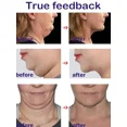 thumbnail image 4 of Crema adelgazante facial para eliminar la papada, extracto de hierbas naturales, 20g, 4 of 5