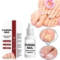thumbnail image 2 of 15ml Nail Repair Solution For Cuticle Care And Nail Strengthening, 2 of 8