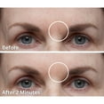 thumbnail image 6 of Dermaflage Scar Filler, Acne Scar Filler, Scar Concealer Makeup, 1 mo supply - Fair, 6 of 10