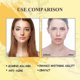 thumbnail image 3 of OUHOE Turmeric Facial Repair Essence, skin repair, anti-wrinkle, lightening of fine lines and dark spots, hydrating and mo, 3 of 4