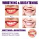 thumbnail image 1 of Lápiz de dientes de tóner morado de 3 ml, reparación brillante Mini para cuidado bucal de adultos (1 unidad) Sywqhk Cuidado Belleza, 1 of 5