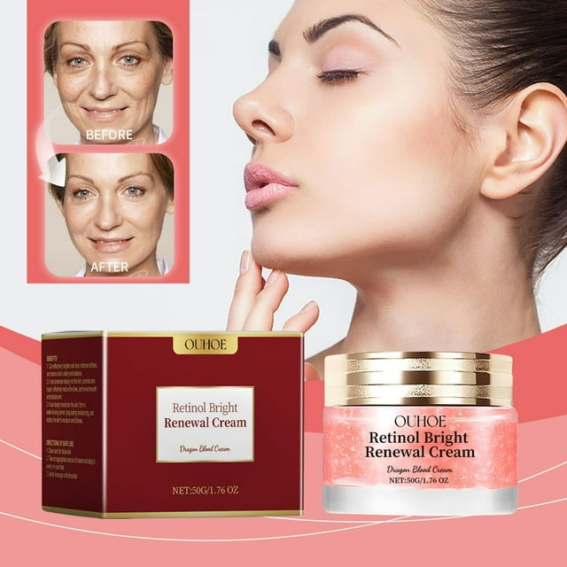 hidratante facial con aceite de rosa mosqueta | hidrata profundamente, nutre y rejuvenece la piel | frasco de 50 g frasco rojo con tapa dorada y etiqueta frontal, crema visible en frasco abierto; caja roja junto al envase y perfil de mujer con piel limpia en fondo blanco-rosado, adecuado para rutina de cuidado facial y nutrición facial diaria.