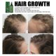 thumbnail image 3 of Jaysuing Hair Dense Hair Liquid Strong And Tough Hair Urising Hair Root Growth Thick Scalp Massage Nutrient Solution |, 120 ml, 3 of 4