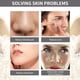 thumbnail image 4 of Salud y Belleza, Cuidado Personal, Cremas, Crema Hidratante, Cremas y Humectantes, Crema Blanqueadora Facial para Cerrar Poros Abiertos, Suero Exfoliante de Arroz, 140 g, un gel, 4 of 9