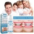 thumbnail image 2 of Retainer Cleaner spray - 1Fresh, Stain-Free Retainer Cleaning spray, Invisalign, Gum Shield, Mouth Guard, Denture Cleaner, 2 of 5