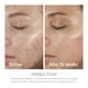 thumbnail image 4 of Cuidado de la piel Epionce Lytic Tx para pieles normales a mixtas, 4 of 9