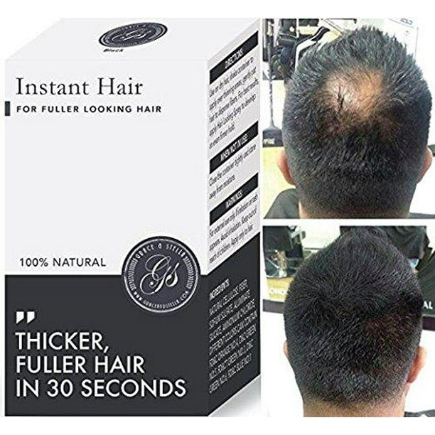 Instant Hair Loss Treatment for Men &amp; Women 100