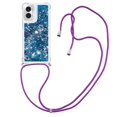 thumbnail image 1 of Funda FOXDOCK para Motorola Moto G Play 4G 2024 con Cuerda Ajustable, Brillo Líquido, Protección Antigolpes y Lente – Ideal para Regalo, 1 of 6