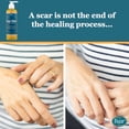 thumbnail image 2 of Scar-Ban Massage Lotion, 8 oz, 2 of 4