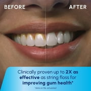 Waterpik Cordless Plus Water Flosser with 2 Settings, 4 Tips, ADA Accepted, White