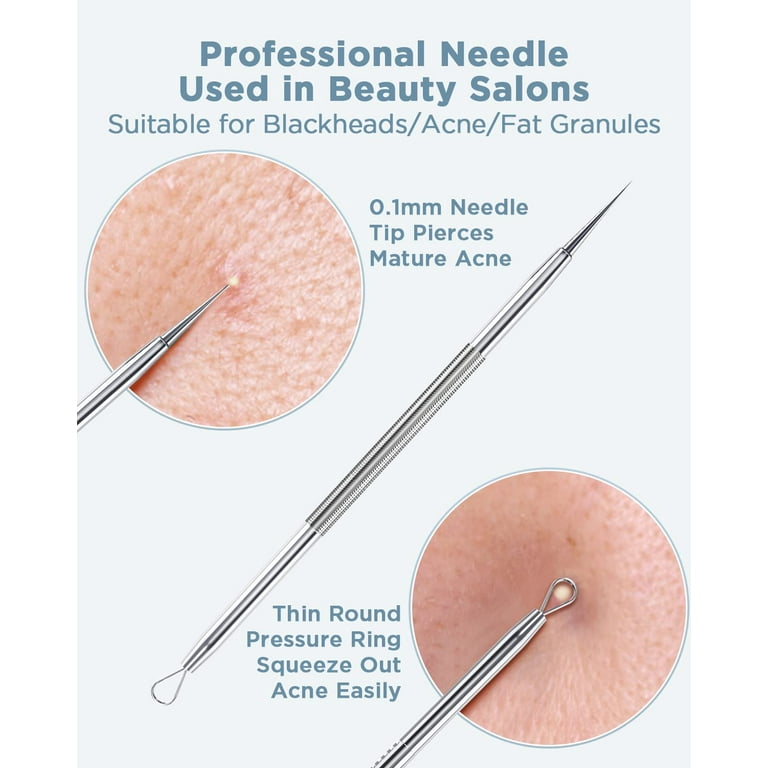 Blackhead extraction sale