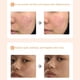 thumbnail image 5 of Mascarilla facial de belleza Mask Stick Limpia profundamente los poros Mejora la piel Ilumina el tono de la piel Mask Stick 40g (Compra 2 y ahorra 10%) Autorización, 5 of 8