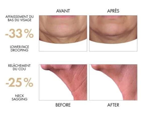 Vichy Neovadiol Phytosculpt Neck & Face Contours Cream 50ml/1.69oz