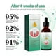 thumbnail image 3 of 1-3ps Gum Repair Serum Drops Relieve Receding Gum Periodontal Blistering Care Teeth Whiten Remove Yellow Toothache Toothpaste, 3 of 5