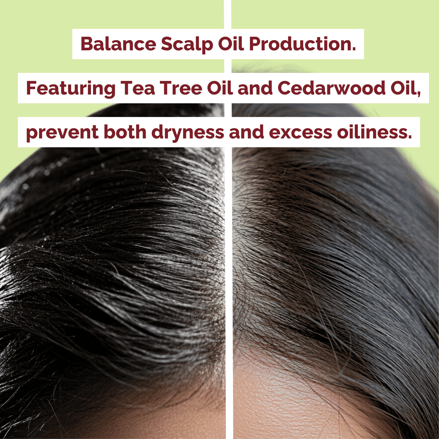 Just Nutritive Onion & Rosemary Shampoo for Hair Growth, Hair Loss, Oil Control, Thickening and Strengthening, Sulfate-Free, Enriched with Red Onion Oil, Rosemary Oil, Tea Tree - 16 oz