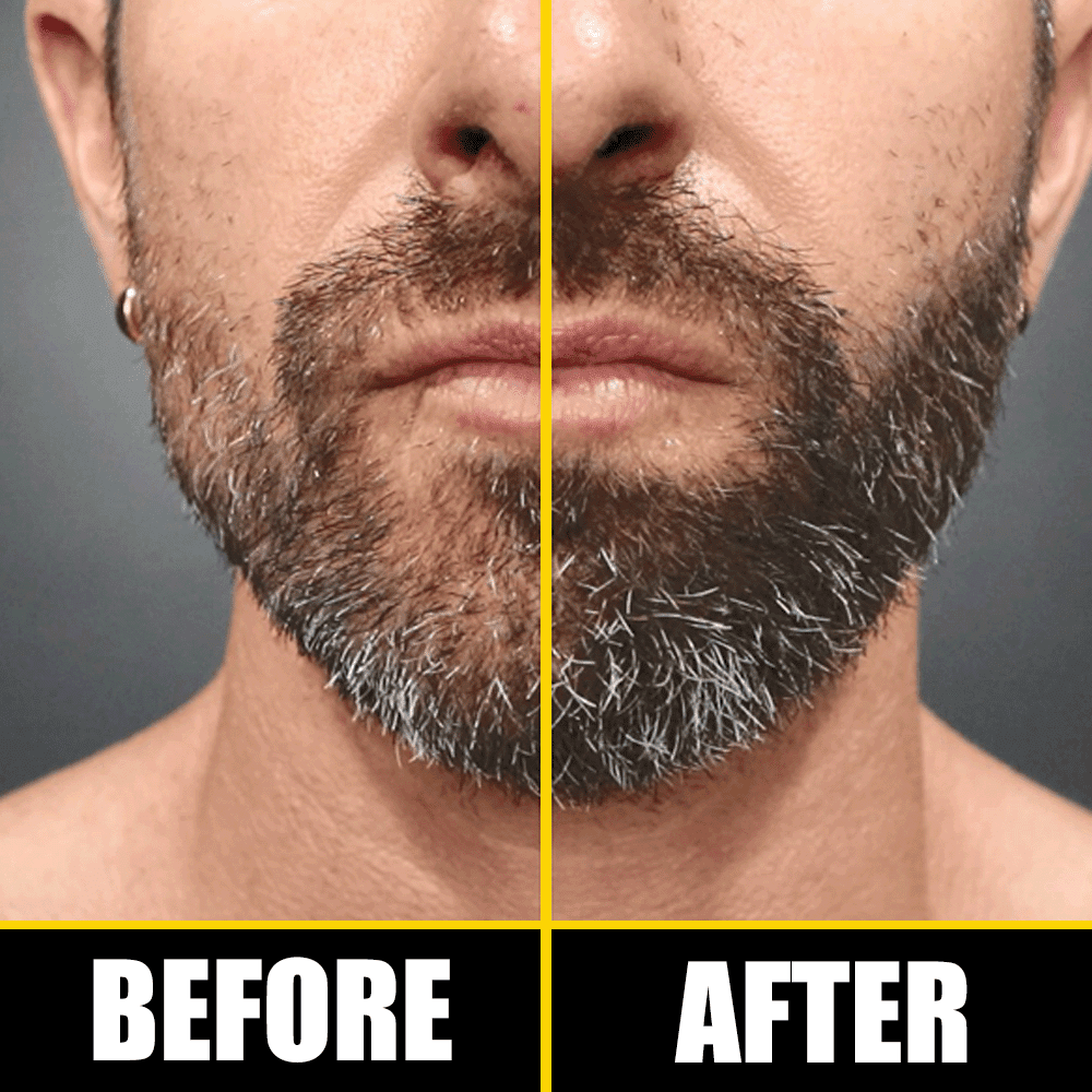 Pete & Pedro BOOST Hair & Beard Growth Strengthening Serum With Biotin & Rosemary, 2 oz