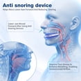 thumbnail image 2 of Anti-Snoring Mouth Guard & Mouthpiece - Adjustable, Customizable, Comfortable for Men and Women - Enhanced Sleep Experience (Blue-1pcs), 2 of 7