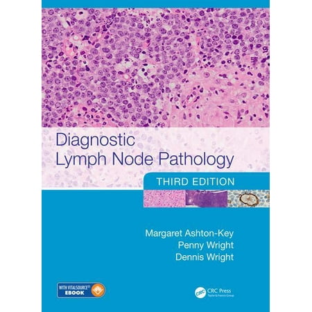 UPC: 9781498732697 | Diagnostic Lymph Node Pathology (Hardcover)