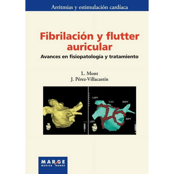 FibrilaciÃ³n y flutter auricular: Avances en fisiopatologÃ­a y tratamiento, (Paperback)