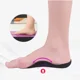 thumbnail image 5 of 2 pares de plantillas ortopédicas para pies planos XO-Legs, corrección de arco para eversión e inversión del pie, fascitis Plantar, cuidado de los pies, 5 of 5