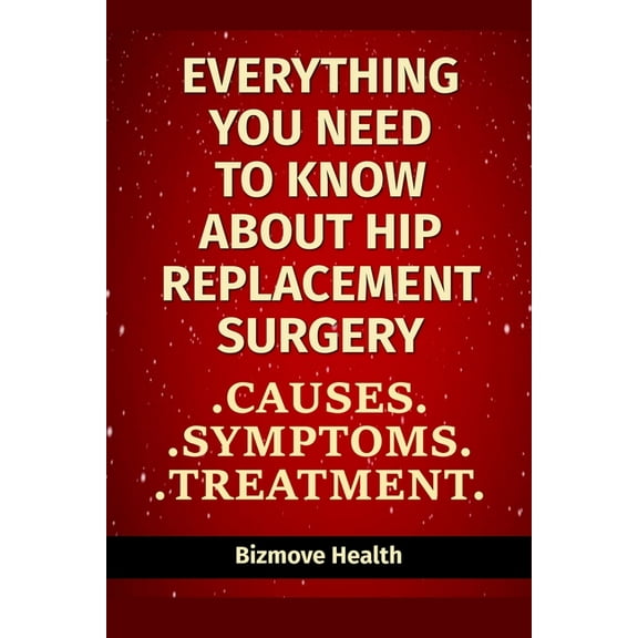 Everything you need to know about Hip Replacement Surgery: Causes, Symptoms, Treatment (Paperback)