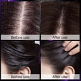 thumbnail image 6 of Clarifying Shampoo,Clarifying Shampoo For Women,Shampoo For Oily Hair,Sulfate Free Shampoo,Remimpi Anti Hair Loss Shampoo Makeup Organizers, 6 of 9
