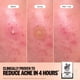 thumbnail image 3 of Parches hidrocoloides para granitos Acne Healing Dots PEACE OUT, 20 unidades, 3 of 8