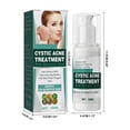 thumbnail image 3 of Promotional activities!Cystic, Hormonal, And Severe Acne Cream For Teens & Adults Acne With Special Acne Ingredients, 3 of 9