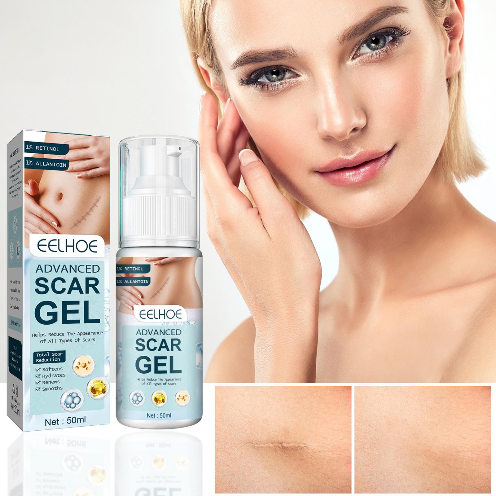 Scar Gel Safe & Gentle Scar Removal Cream with Retinol, Allantoin