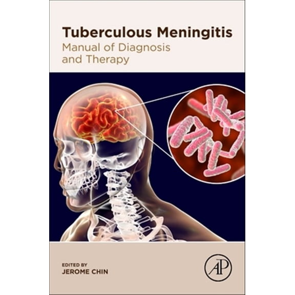 Pre-Owned Tuberculous Meningitis: Manual of Diagnosis and Therapy, (Paperback)