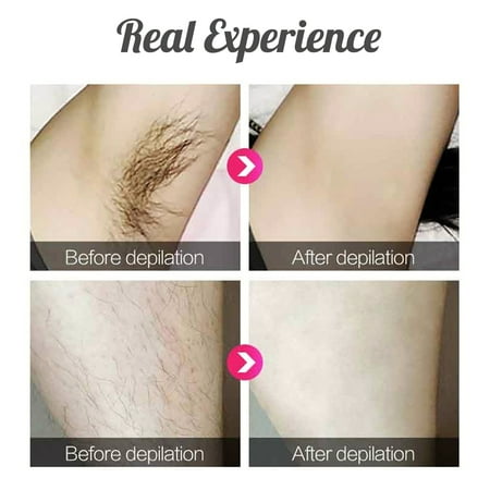 epilator painless bezahlung