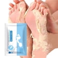 thumbnail image 1 of Exfoliating Foot Peel Mask For Soft 1Pair Peel - Peel 3ml, 1 of 5