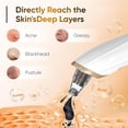 thumbnail image 2 of Blackhead Remover Vacuum - Professional Blackhead Extractor for Face with 3 Adjustable Suction Levels, USB Rechargeable Pore Cleaner, and 5 Interchangeable Probes (White), 2 of 7