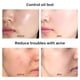 thumbnail image 4 of Limpiador Facial Exfoliante Ganfancp Olive Peptide Antiarrugas Reafirmante 80Ml, 4 of 7
