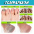 thumbnail image 3 of 3PCS Foot And Nail Spary, Natural And Powerful Foot Care - Miao, 3 of 5