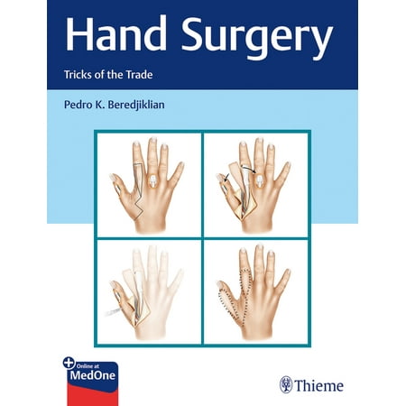 UPC: 9781626234796 | Hand Surgery: Tricks of the Trade (Hardcover)