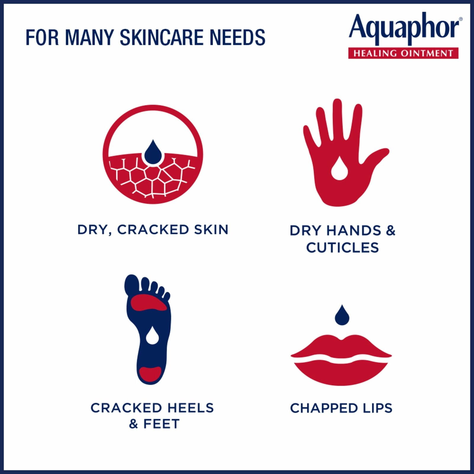 Aquaphor Advanced Therapy Healing Ointment Skin Protectant Tube, Unscented, 1.75 oz (4 Pack) (Bundle)