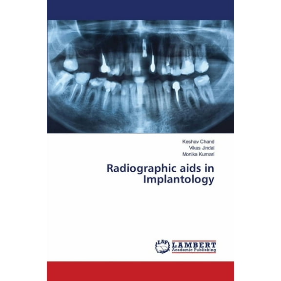 Radiographic aids in Implantology, (Paperback)