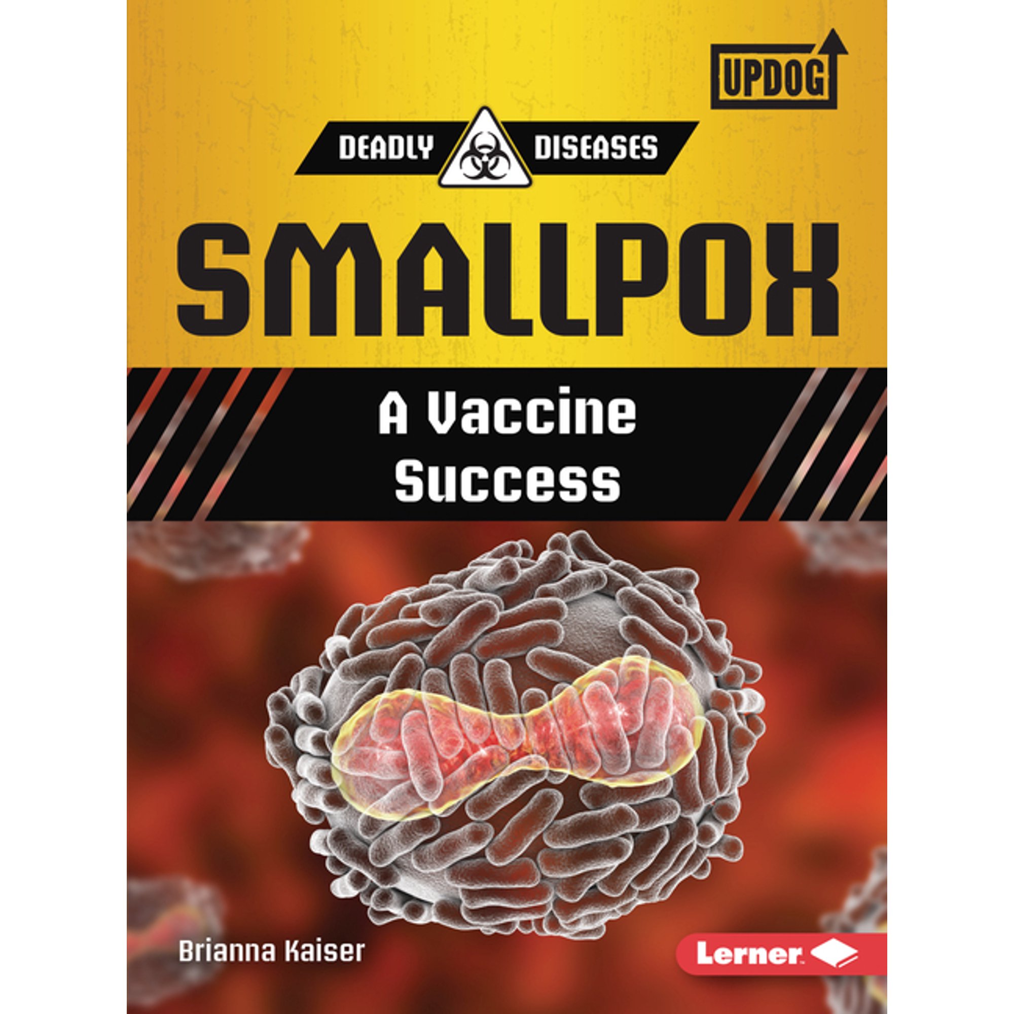 Deadly Diseases (Updog Books (Tm)): Smallpox: A Vaccine Success (Paperback)