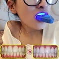 thumbnail image 2 of Blanqueador de dientes azul, luz cosmética, aparatos blanqueadores de dientes, blanqueador de dientes portátil para el hogar, cuidado bucal, Blu-ray saludable, 2 of 5
