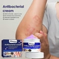 thumbnail image 3 of Crema para aliviar la picazón en la piel con violeta de South Moon, alivia las picaduras de insectos y la picazón en la piel, crema tópica antipicazón | |, 3 of 4