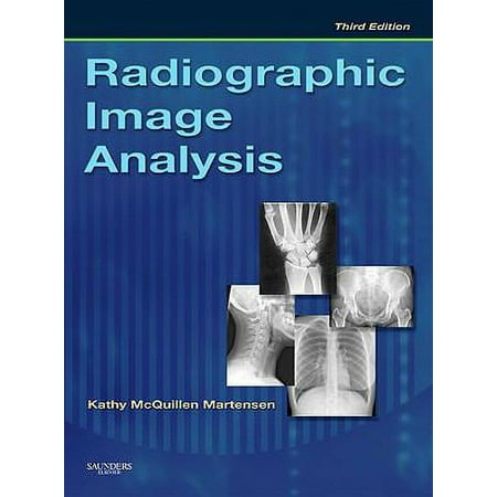 Radiographic Image Analysis [Hardcover - Used]